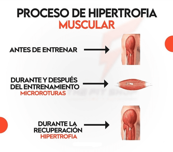 hipertrofia